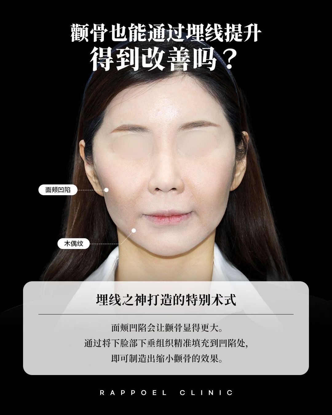案例1